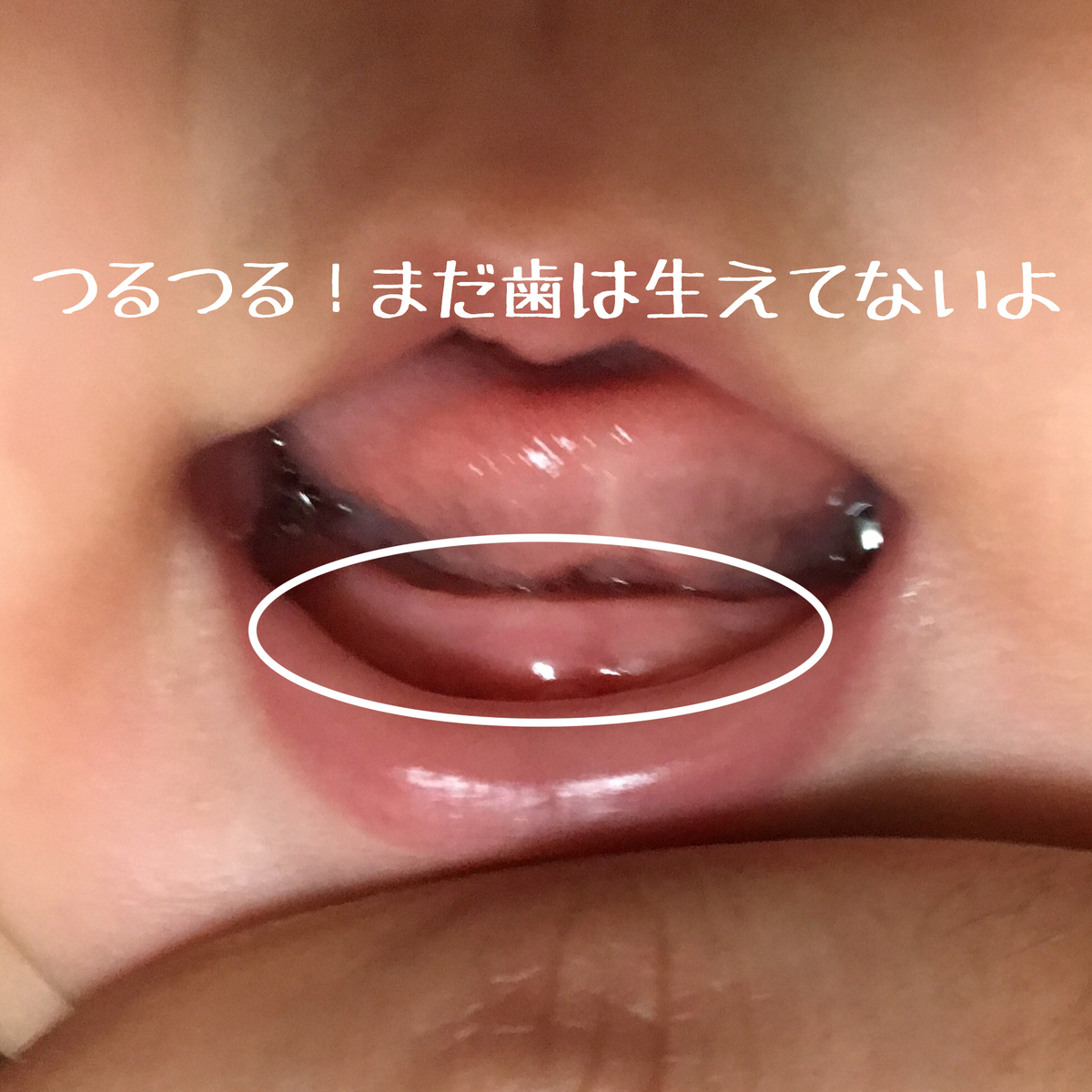 生後3ヶ月の口の中 生後3か月の口の中