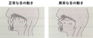 飲み込むときの舌の正しい動き